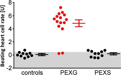 Inhibitory and Agonistic Autoantibodies Directed Against the β2-Adrenergic Receptor in Pseudoexfoliation Syndrome and Glaucoma